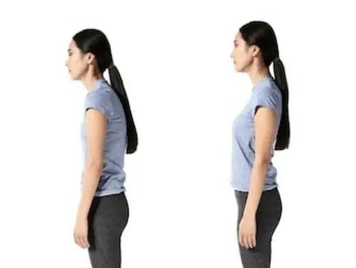 成人严重驼背视频讲解图,成人严重驼背成因及矫正方法解析